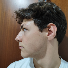 MattiaEspo