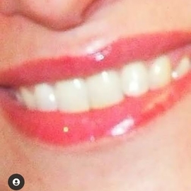 Cosmo11